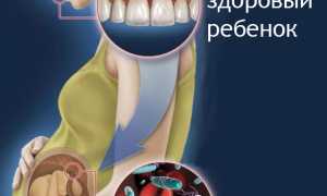 Лечение зубов при беременности: когда, как и чем безопасно лечить