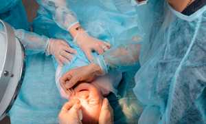 Зондирование слёзного канала у новорождённых: что важно знать перед и после процедуры