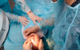 Зондирование слёзного канала у новорождённых: что важно знать перед и после процедуры