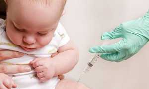 Желтушка у новорожденных: симптомы, лечение, нормы