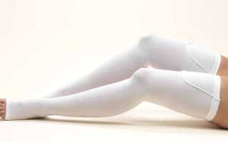 Хроническая венозная недостаточность. От симптома и диагноза к лечению