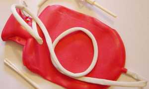 Спринцевание содой для зачатия – рецепт и правила использования