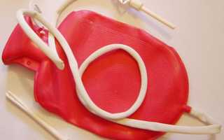 Спринцевание содой для зачатия – рецепт и правила использования