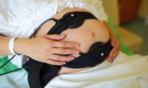 Как делают КТГ во время беременности и что показывает этот анализ