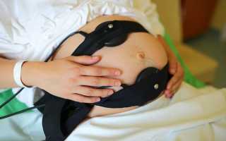 Как делают КТГ во время беременности и что показывает этот анализ