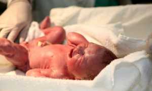 Шкала Апгар – для чего она нужна и что показывает