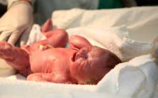 Шкала Апгар – для чего она нужна и что показывает