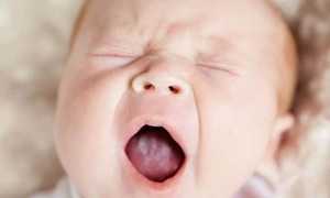 Молочница у новорожденных во рту: лечение, профилактика, советы 2025