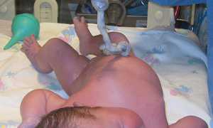 Как обработать пупок новорожденного дома — пошаговый гид