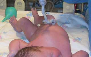 Как обработать пупок новорожденного дома — пошаговый гид