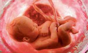 Почему новорожденный икает: причины, профилактика, помощь