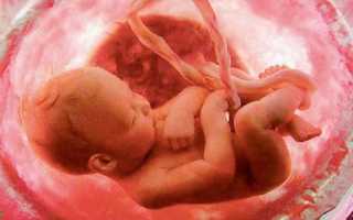 Почему новорожденный икает: причины, профилактика, помощь