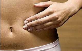 Гастроптоз