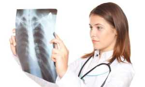 Можно ли делать флюорографию при планировании беременности и когда лучше сделать