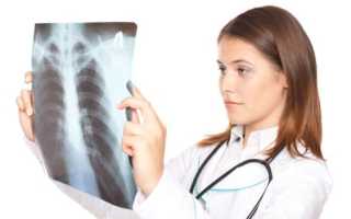 Можно ли делать флюорографию при планировании беременности и когда лучше сделать