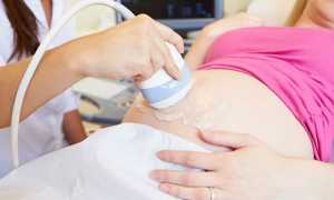 Что такое допплерометрия при беременности и зачем ее проводят