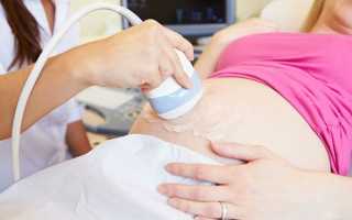 Что такое допплерометрия при беременности и зачем ее проводят