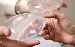 Делать ли пластику груди, и какой метод выбрать?