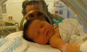 Галактоземия у новорождённых: симптомы, диагностика и лечение 2025