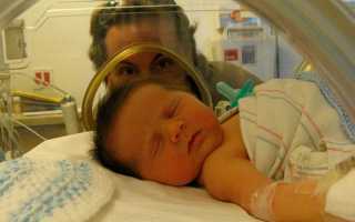 Галактоземия у новорождённых: симптомы, диагностика и лечение 2025