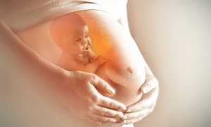 Естественные роды после кесарева сечения: можно ли и как подготовиться