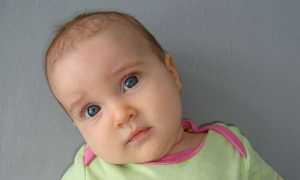 Кривошея у новорожденных: признаки, лечение и профилактика