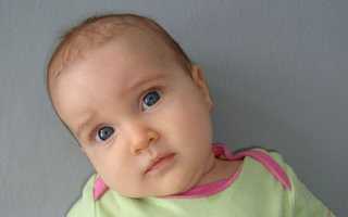 Кривошея у новорожденных: признаки, лечение и профилактика