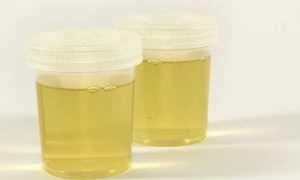 Анализы при беременности: полный список по триместрам, сроки и расшифровка