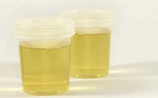 Анализы при беременности: полный список по триместрам, сроки и расшифровка