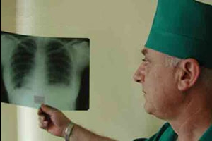 Симптомы и лечение туберкулёза почек в Москве Симптомы и лечение туберкулёза почек в Москве