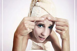 Как избавится от прыщей на лбу?