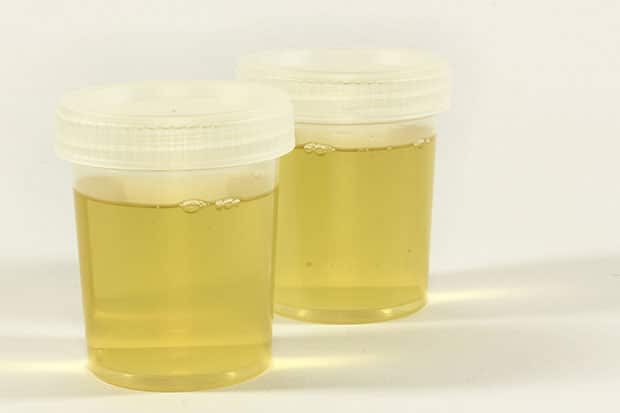 анализы при беременности