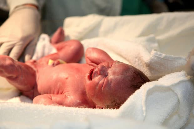 оценка по шкале апгар