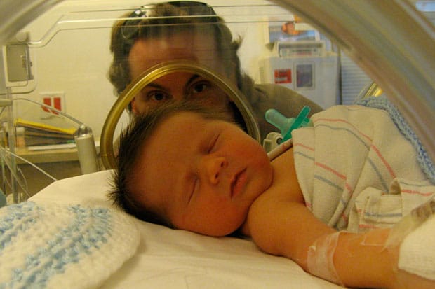 симптомы галактоземии у новорожденных