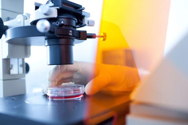 диагностика микоплазмы у женщин