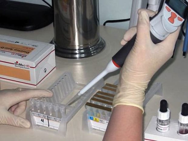 диагностика ротавируса у детей